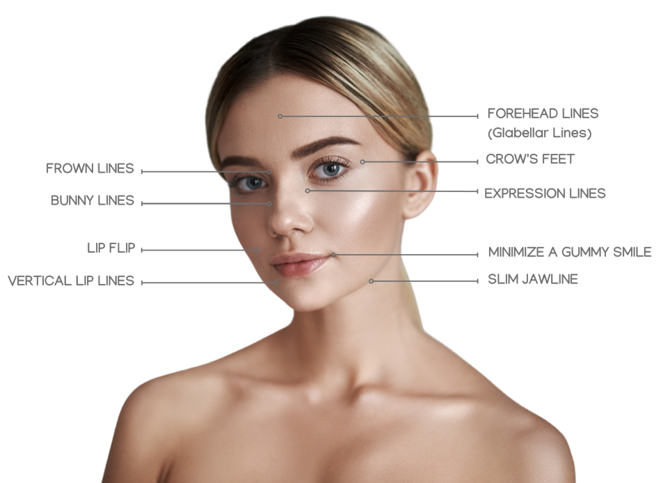Woman with beautiful and youthful radiance modeling for the Botox Treatment Areas possible at Haus of Aesthetics.