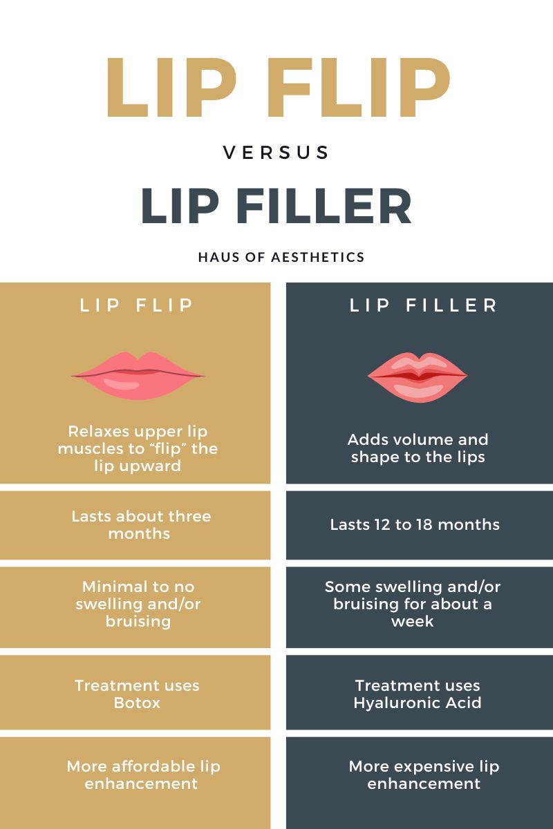 Comparison of Lip Flip Vs Lip Filler